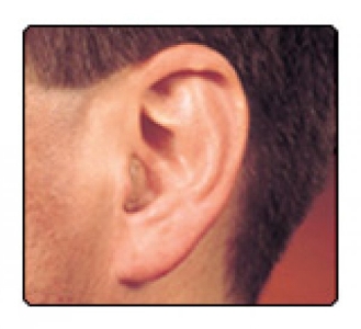 In-the-Ear Hearing Instruments (ITEs)
